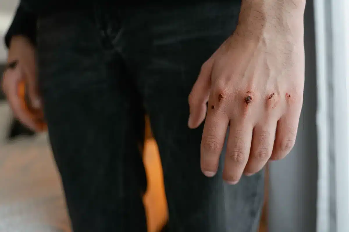 Signore ferito a terra durante uno scontro in una fortezza medievale